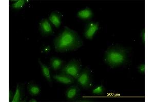 Immunofluorescence of monoclonal antibody to CDR2 on HeLa cell. (CDR2 Antikörper  (AA 296-404))