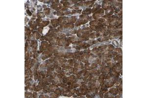 Immunohistochemical staining of human pancreas with CLCC1 polyclonal antibody  shows strong cytoplasmic positivity in exocrine glandular cells at 1:200-1:500 dilution. (CLCC1 Antikörper)