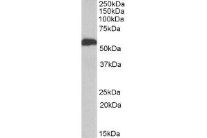 ABIN2561038 (1µg/ml) staining of Human Liver lysate (35µg protein in RIPA buffer). (ALDH5A1 Antikörper  (AA 301-312))