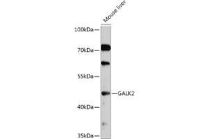 Western blot analysis of extracts of Mouse liver, using G antibody (ABIN7267329) at 1:1000 dilution. (GALK2 Antikörper  (AA 109-458))