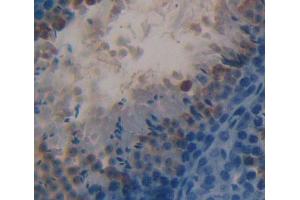Used in DAB staining on fromalin fixed paraffin- embedded testis tissue (HSD17B3 Antikörper  (AA 1-310))