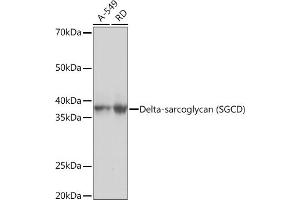 Western blot analysis of extracts of various cell lines, using Delta-sarcoglycan (SGCD) Rabbit mAb (ABIN7270144) at 1:1000 dilution. (SGCD Antikörper)
