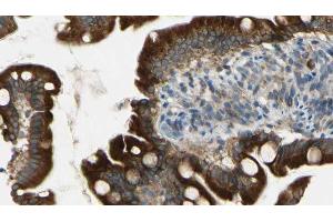 ABIN6269135 at 1/100 staining Mouse intestine tissue by IHC-P. (BCR Antikörper  (Internal Region))