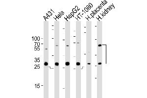 Western blot analysis of lysates from A431, Hela, HepG2, HT-1080 cell line and human placenta, kidney tissue lysate (from left to right), using CTSA Antibody (N-term) (ABIN654433 and ABIN2844169).