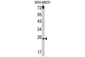 Western blot analysis of LTA Antibody (Center) in MDA-MB231 cell line lysates (35ug/lane).