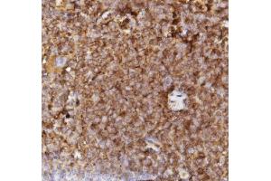 IHC analysis of Sca1/Ly6A/E using anti-Sca1/Ly6A/Eantibody (ABIN5518854).