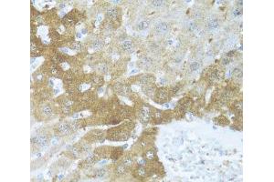 Immunohistochemistry of paraffin-embedded Mouse liver using BCL2L2 Polyclonal Antibody at dilution of 1:100 (40x lens). (BCL2L2 Antikörper)