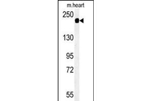 Western blot analysis of SD9L Antibody (C-term) (ABIN651359 and ABIN2840201) in mouse heart tissue lysates (35 μg/lane). (SAMD9L Antikörper  (C-Term))