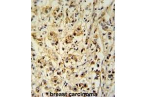 Immunohistochemistry (IHC) image for anti-Small Cell Adhesion Glycoprotein (SMAGP) antibody (ABIN3002290) (SMAGP Antikörper)