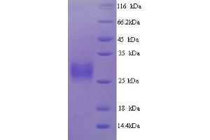 SDS-PAGE (SDS) image for Green Fluorescent Protein (GFP) (AA 1-238), (full length) protein (His tag) (ABIN5714102)