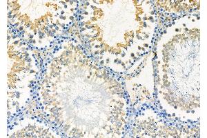 ABIN6263399 and ABIN6277160 at 1/100 staining Rat testis tissue by IHC-P.
