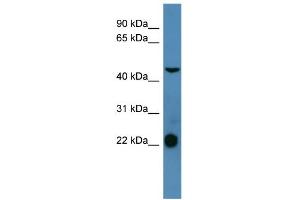 WB Suggested Anti-SSTR1 Antibody Titration: 0. (SSTR1 Antikörper  (C-Term))