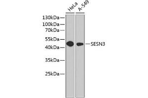 Western blot analysis of extracts of various cell lines, using SESN3 antibody (ABIN6129128, ABIN6147627, ABIN6147628 and ABIN6220862) at 1:1000 dilution. (SESN3 Antikörper  (AA 1-310))