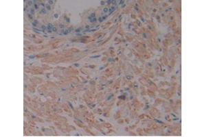 IHC-P analysis of Human Prostate Gland Tissue, with DAB staining. (MMP2 Antikörper  (AA 110-660))