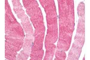 Human Skeletal Muscle: Formalin-Fixed, Paraffin-Embedded (FFPE) (PDCL3 Antikörper  (C-Term))