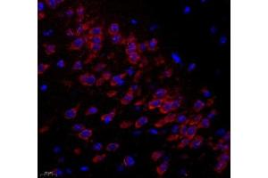 Immunofluorescence of paraffin embedded mouse hippocampus using C1orf173 (ABIN7074073) at dilution of 1: 300 (400x lens) (Glutamate-Rich Protein 3 (ERICH3) Antikörper)