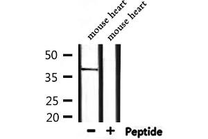 Western blot analysis of extracts from mouse heart, using BMI1 Antibody. (BMI1 Antikörper  (Internal Region))