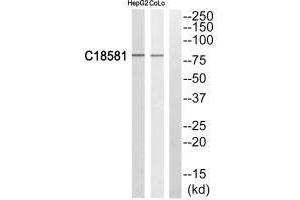 Western blot analysis of extracts from HepG2 cells and COLO205 cells, using NEK5 antibody. (NEK5 Antikörper)