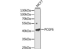 Western blot analysis of extracts of MCF7 cells, using PCGF6 antibody (ABIN2564409) at 1:1000 dilution.