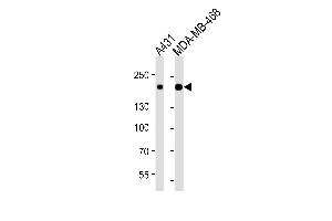 Western blot analysis of lysates from A431, MDA-MB-468 cell line (from left to right), using EGFR Antibody (ABIN387816 and ABIN2843905). (EGFR Antikörper)