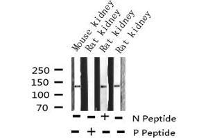 Western blot analysis of Phospho-Calcium Sensing Receptor (Thr888) expression in various lysates (CASR Antikörper  (pThr888))
