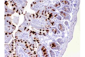 IHC analysis of TFF3 using anti-TFF3 antibody . (TFF3 Antikörper  (AA 23-81))