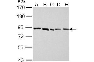 WB Image APLP2 antibody [N1N2], N-term detects APLP2 protein by Western blot analysis.