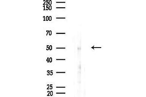 Western blot analysis of lysates from HUVEC cells(starvation,24h treatment), using WASF3 Antibody at 1/1000 dilution.