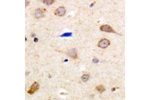 Immunohistochemical analysis of EDG5 staining in human brain formalin fixed paraffin embedded tissue section. (S1PR2 Antikörper  (C-Term))