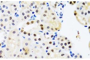 Immunohistochemistry of paraffin-embedded Mouse kidney using SET Polyclonal Antibody at dilution of 1:100 (40x lens). (SET/TAF-I Antikörper)