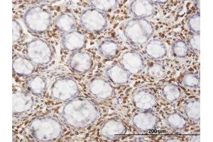 Image no. 1 for anti-Hematopoietic Cell-Specific Lyn Substrate 1 (HCLS1) (AA 266-356) antibody (ABIN598725) (HCLS1 Antikörper  (AA 266-356))