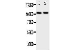 Anti-Zonula occludens protein 3 antibody, Western blotting Lane 1: Rat Brain Tissue Lysate Lane 2: Rat Heart Tissue Lysate (TJP3 Antikörper  (C-Term))