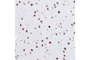 Immunohistochemistry of paraffin-embedded rat brain using p73 Rabbit mAb (ABIN1678945, ABIN1678944, ABIN7101487 and ABIN7101488) at dilution of 1:100 (40x lens). (Tumor Protein p73 Antikörper)
