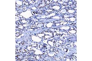 IHC analysis of SF3A1 using anti-SF3A1 antibody (ABIN7600556). (SF3A1 Antikörper  (AA 20-556))
