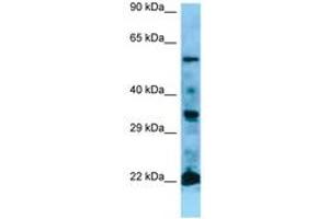 Image no. 1 for anti-GTPase NRas (NRAS) (AA 91-140) antibody (ABIN6749779) (GTPase NRas Antikörper  (AA 91-140))