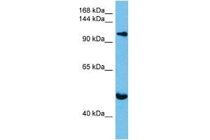 Host:  Mouse  Target Name:  KIF23  Sample Tissue:  Mouse Brain  Antibody Dilution:  1ug/ml (KIF23 Antikörper  (N-Term))