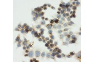 ICC testing of IGF2R antibody and HCT116 cells (IGF2R Antikörper  (C-Term))