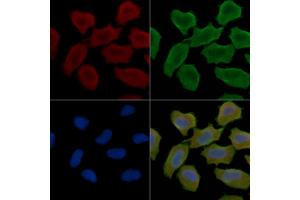 ABIN6266206 and ABIN6277362 staining Hela cells(30 min of UV treatment) by IF/ICC.