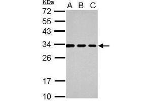 WB Image Sample (30 ug of whole cell lysate) A: 293T B: A431 C: HeLa 12% SDS PAGE antibody diluted at 1:1000 (Tetraspanin 3 Antikörper)