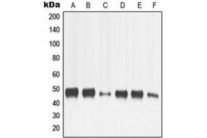 Western blot analysis of MMP13 expression in HeLa (A), SP2/0 (B), H9C2 (C), MCF7 (D), HT1080 (E), SCC4 (F) whole cell lysates. (MMP13 Antikörper  (N-Term))