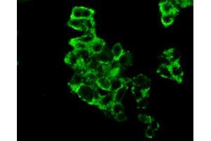 Immunohistochemistry (IHC) image for anti-Hexokinase 2 (HK2) (AA 469-669) antibody (ABIN1980424)