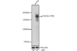 Western blot analysis of extracts of A-431 cells, using Phospho-PLC gamma 1 (PLCG1)-Y783 antibody (ABIN3019685, ABIN3019686, ABIN3019687 and ABIN1681934) at 1:1000 dilution. (Phospholipase C gamma 1 Antikörper  (pTyr783))