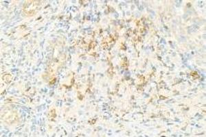 Immunohistochemistry analysis of paraffin-embedded rat ovary using,NRK (ABIN7074842) at dilution of 1: 1500 (NRK Antikörper)