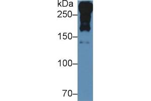 Detection of LAMA1 in Rat Serum using Polyclonal Antibody to Laminin Alpha 1 (LAMA1) (Laminin alpha 1 Antikörper  (AA 1156-1276))
