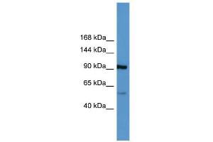 WB Suggested Anti-LPA Antibody Titration: 0. (LPA Antikörper  (Middle Region))