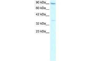 WB Suggested Anti-TBP Antibody Titration:  2. (TBP Antikörper  (Middle Region))