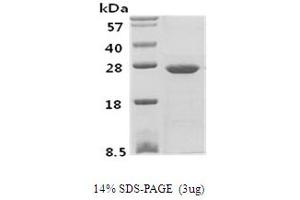 SDS-PAGE (SDS) image for Phosphoserine Phosphatase (PSPH) protein (ABIN666688) (PSPH Protein)