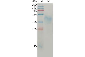 Human A1 Protein, His Tag on SDS-PAGE under reducing condition.