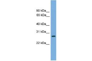 WB Suggested Anti-ATPAF1 Antibody Titration: 0. (ATPAF1 Antikörper  (N-Term))