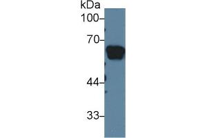Western Blot; Sample: Rat Serum; Primary Ab: 1µg/ml Rabbit Anti-Rat AGT Antibody Second Ab: 0. (AGT Antikörper  (AA 25-477))